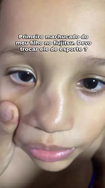 Machucou só um pouquinho 🤣🤘🏼 #jiujitsu #bjj #jiujitsulifestyle #viralvideo 