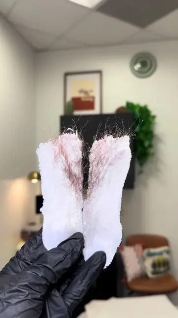 Don’t worry… the strips are over before you know it, and the smooth results last