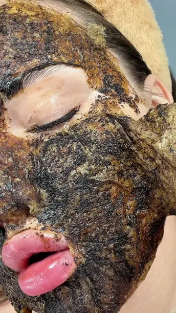 🥚+☕️ = bye-bye pores ✨😮 #skincare #facemask #fyp #mask #foruyou 