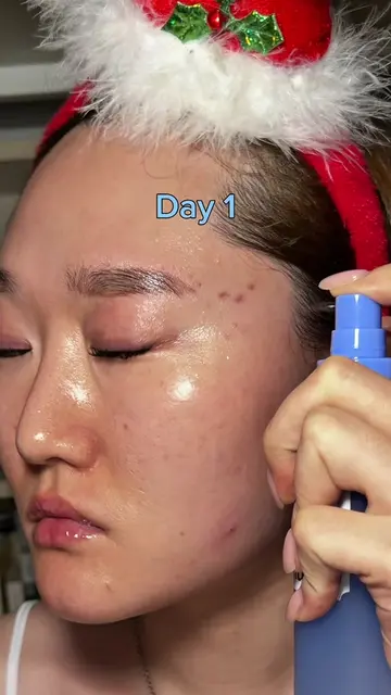 Korean EGF mist to calm red and irritated skin💙 @dear, Klairs #klairs #klairsEG