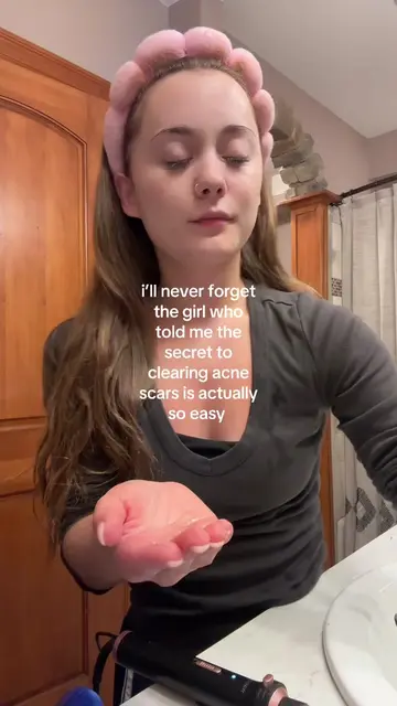 my biggest flex tbh #skintok #hormonalacne #acnescars #beautytips #glassskin 