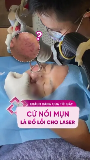 Sau điều trị sẹo lại bị nổi mụn, có phải do laser? #doctorlaser #bsluong #sẹo #l