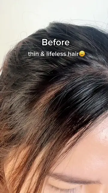 Sharing my Scalp Care routine✨💧💓 #somebymi #haircare #haircareroutine #hairlos