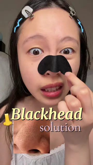 #MilkyDewAcademy 🎀 The Korean pore care secret nobody talks about...🤍✨up to 15