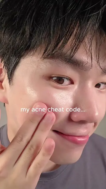 My acne cheat code... This spray toner saved my acne-prone skin  #orien #acne #a