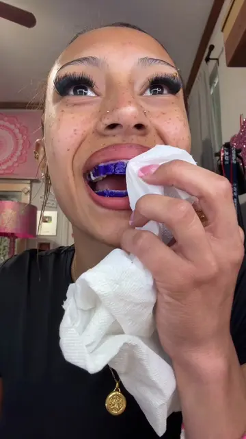 I don’t play bout thesee #foryou #teeth #viral #blowup #funny 