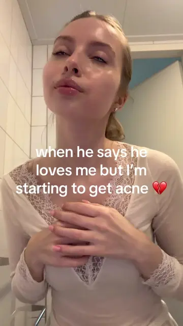 the worst possible timing. #acneproneskin #acnetips #clearskin #acnemakeup #skin