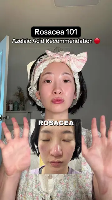 @SKIN1004 US vs @AROMATICA  Love them both but make sure to pick accordingly 💕 