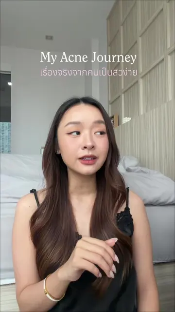 My acne journey คือเรื่องสิวนี่แบบเคยเป็นหนึ่งใน insecurity อันนึงเลยแหละ #เจลซ่