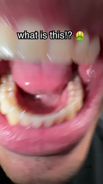 The buildup 😭 #gaptaincrunch #fyp #teethwhitening #viral #ad 