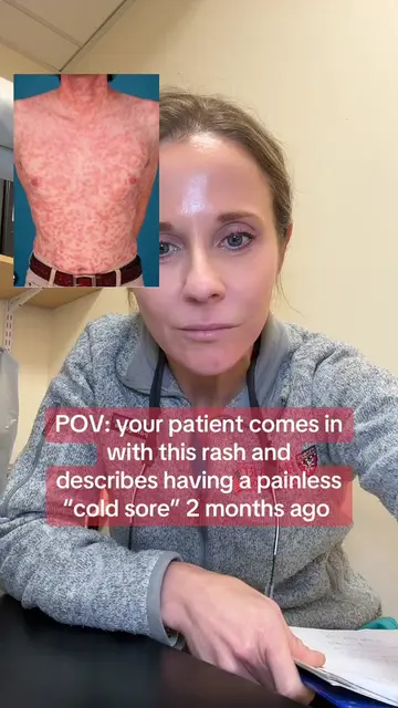 Syphilis is more common than you’d think and presents as a painless chancre, fol