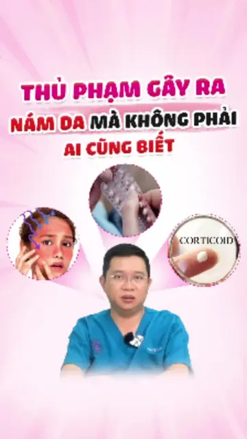 Thủ phạm gây nám da không phải ai cũng biết. #doctorlaser #bsluong #nam #dieutri