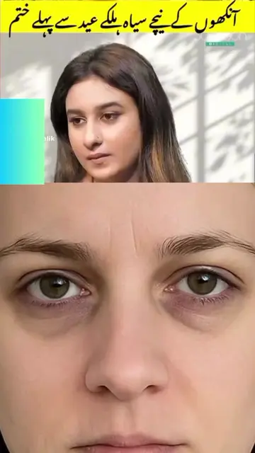 dark circles khatam Karne ka asan nuskha by Amna malik#foryoupage❤️❤️ #skincaret