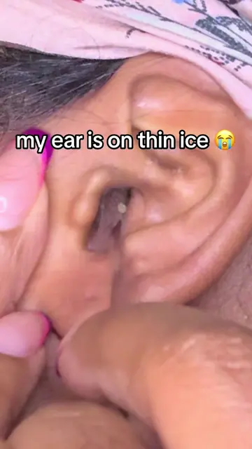 ONE flake ain’t feeding this family 😭💀 #oddlysatisfying #satisfying #earflakes