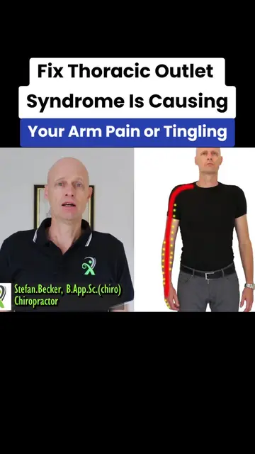 Fix Thoracic Outlet Syndrome, Is THIS Causing Your Arm Pain or Tingling #thoraci