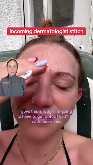 Lessen 11s without Botox? Say no more 🤫  stitch with @charlottealicce #retinoid