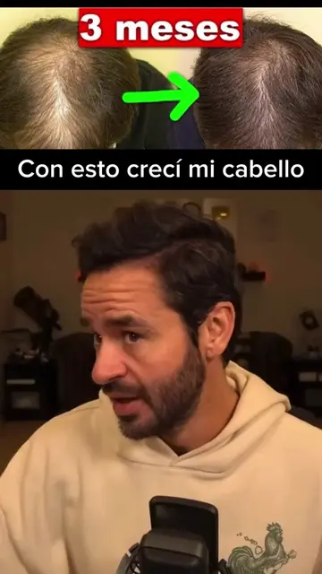#crecimientodelcabello #tips #shampoo #higiene 