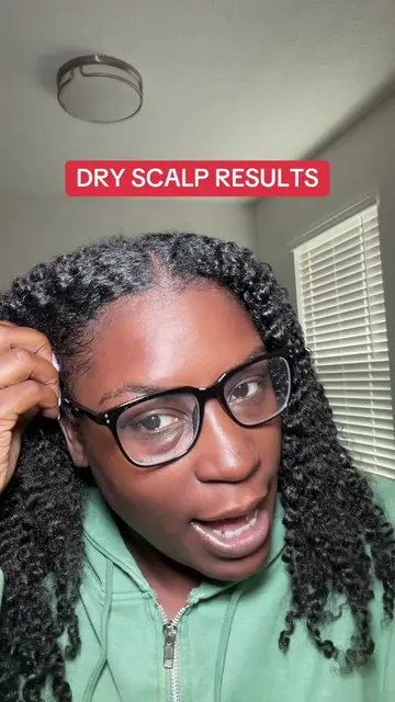 FREE FROM FLAKES AND SCABS FINALLY! #psoriasis #psoriasisawareness #dryscalp #it