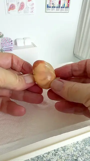 👶 An en caul birth… in miniature. ✨ About 1 in 80,000 babies is born still insi