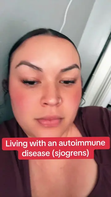 Living with an auto immune disease (sjogrens) #sjogrens #TikTokCreatorSearchInsi
