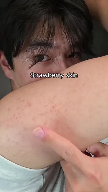 I tried this clarifying toner pad on my strawberry skin, and after just two week