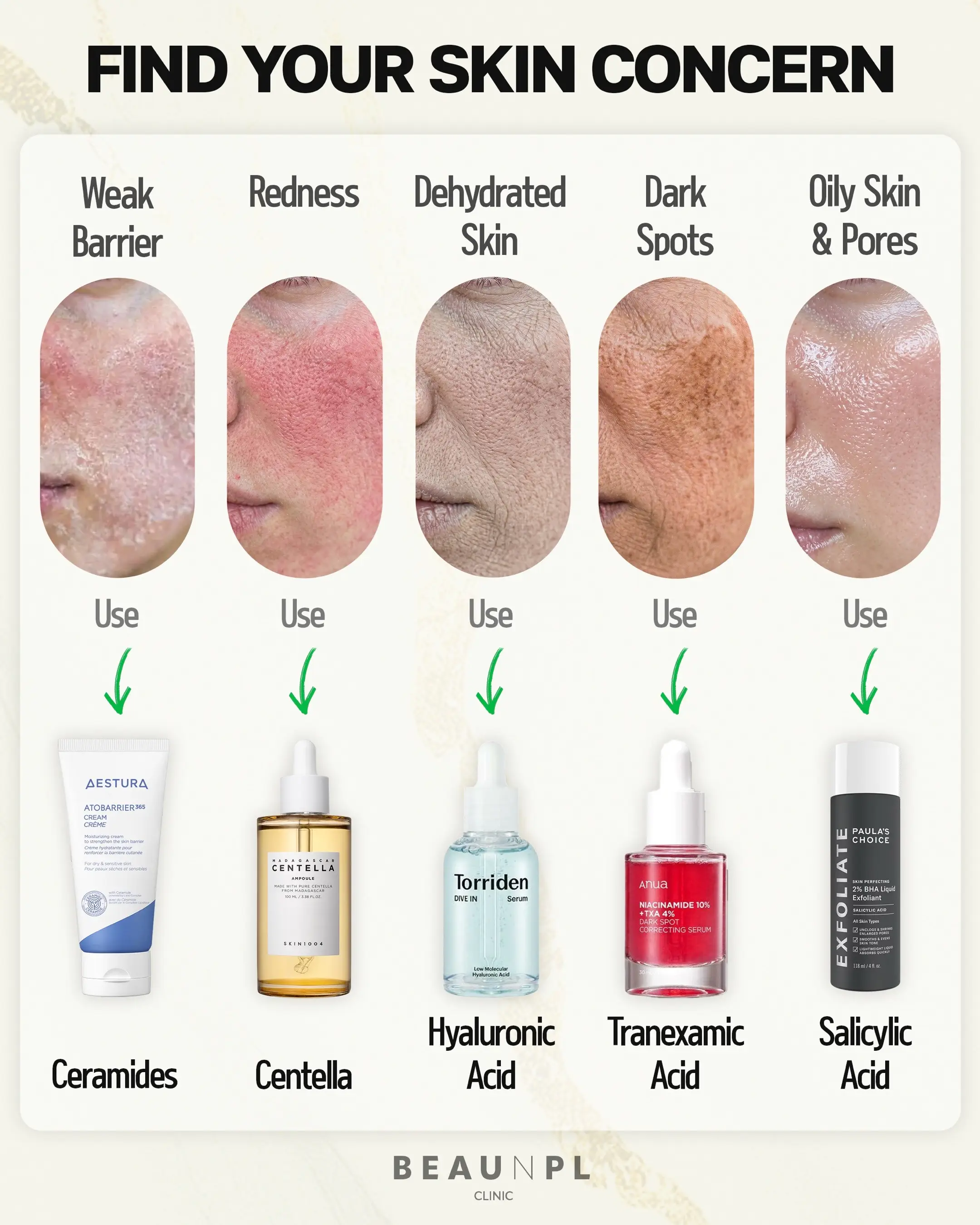 Stop guessing👇 🛡️ Barrier → Ceramides 🌿 Redness → Centella 💧 Dehydration → H