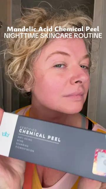 Bringing on the glow with dermaplaning and 40% mandelic acid chemical peel.  Nig
