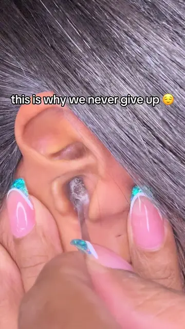 give the pinky the credit it deserves 😭 #oddlysatisfying #satisfying #earflakes