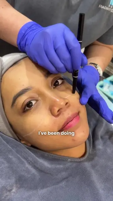 and do uknow botox helps with chronic migraine jugak? This is definitely a 2in1 