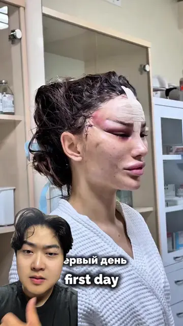 LIGHT SKIN IN 2 MINITES✅#DIY #healthy #beauty #routine #skincare 