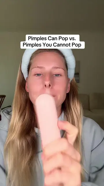 NEVER EVER POP THESE PIMPLES! I found the coolest skincare device that actually 