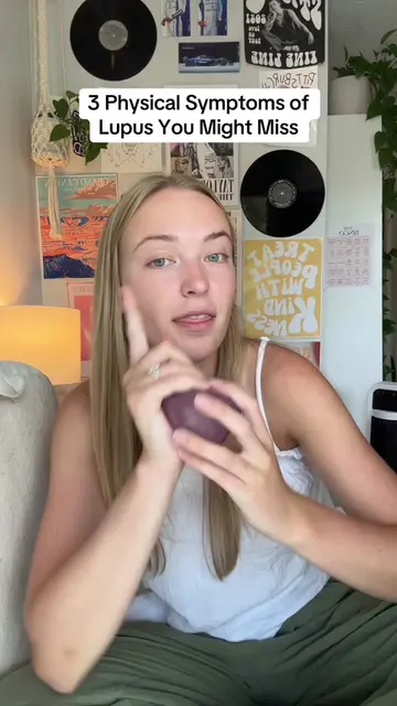 What are your craziest lupus symptoms? #lupusawareness #lupus #medicaltiktok #ch