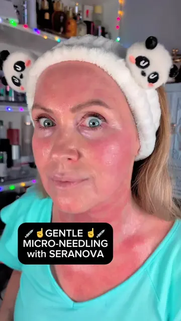 Thinking about trying microneedling at home but feeling a little intimidated? Ge
