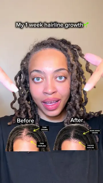 Scalp care is self-care 🌿 The easiest way to upgrade your hair routine? Start w