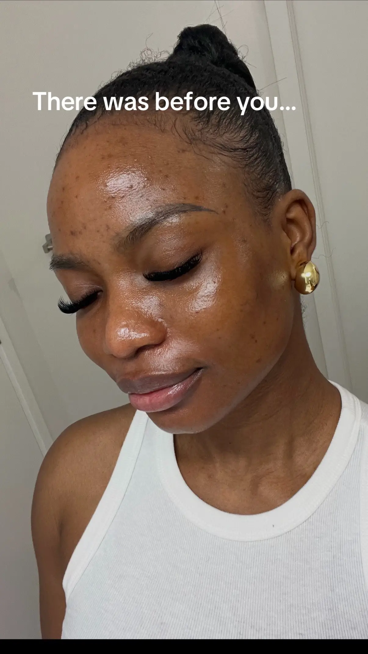 At the beginning of 2023, my skin broke out worse than it ever had. One product 