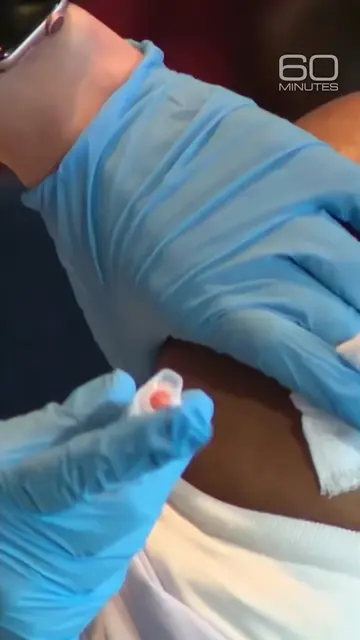 A federal court compensates people who say they were injured by vaccines. Here i