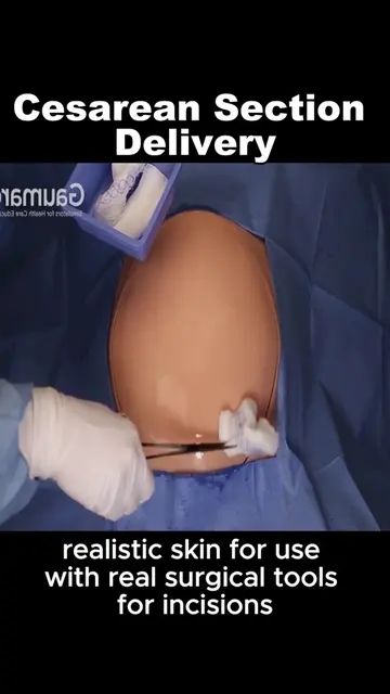 #medicaleducation #healthcare #LearnOnTikTok #fyp 