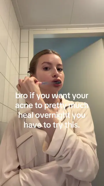 god bless that one girl who showed me the puffin acne app 🥹 literally my holy g