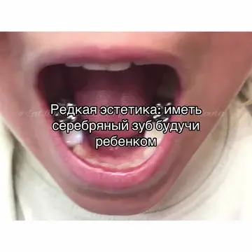 Это очень редко #щп #щитпост #silvertooth #fyp #repost 