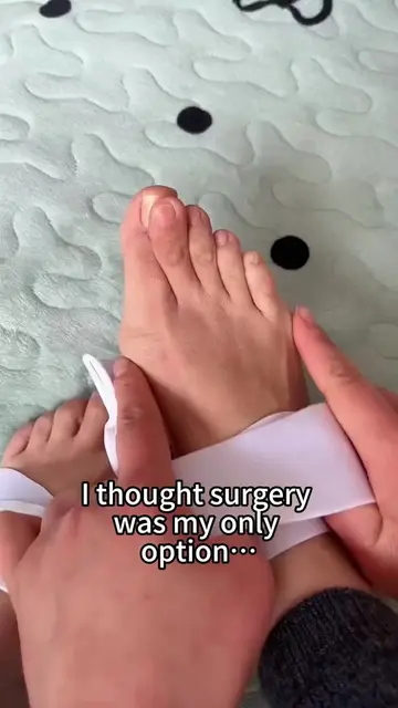 Tired of overlapping toes, sore feet, and shoes that never fit right from bunion