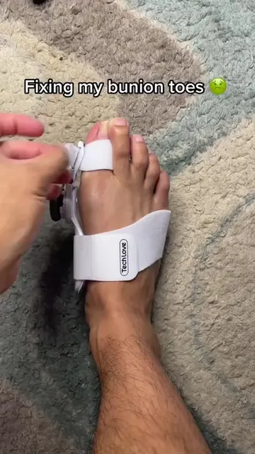 Tired of bunion pain holding you back? 🦶❌ Realign your toes naturally and comfo