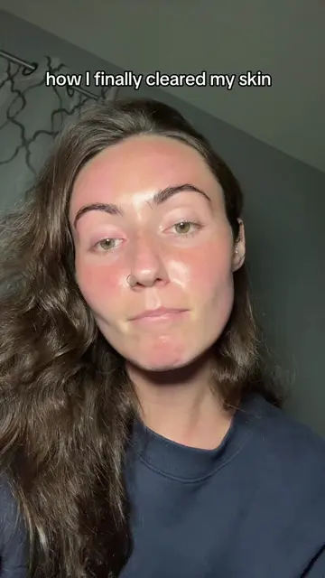 The routine I follow to keep my rosacea under control  AM (pre & post workout) *