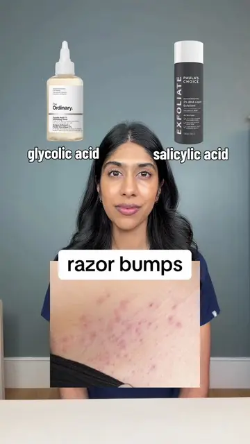 glycolic acid or salicylic acid? #skincaretips #razorbumps #fyp 
