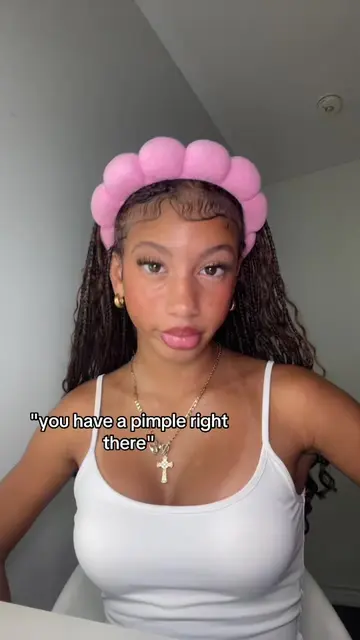 thank you soooo much for pointing that out😀 #fyp #acne #relatable #funny 