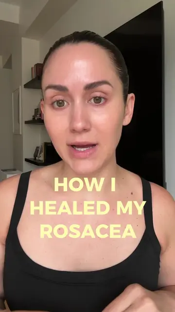 How I healed my rosacea #skincare #rosacea #rosaceaskincare 
