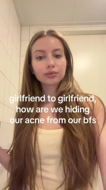 it’s always the worst timing 😭 #acnetips #acneproneskin #acnemakeup #clearskin 
