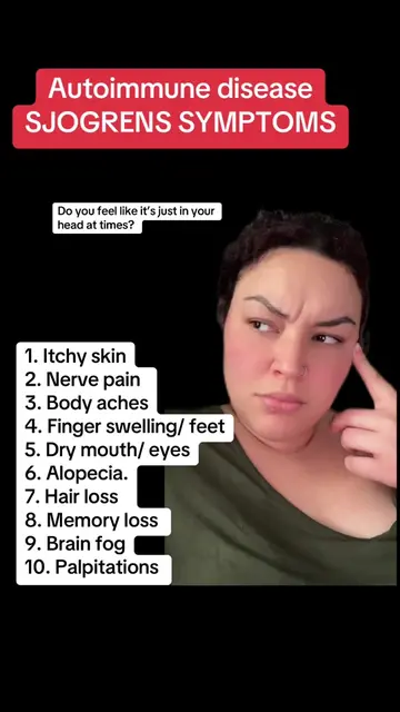 Sjogren’s  autoimmune symptoms sometimes make you think that you’re not even exp