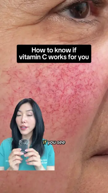 🍊Find out if your vitamin C is irritating your skin!   If your vitamin C serum 