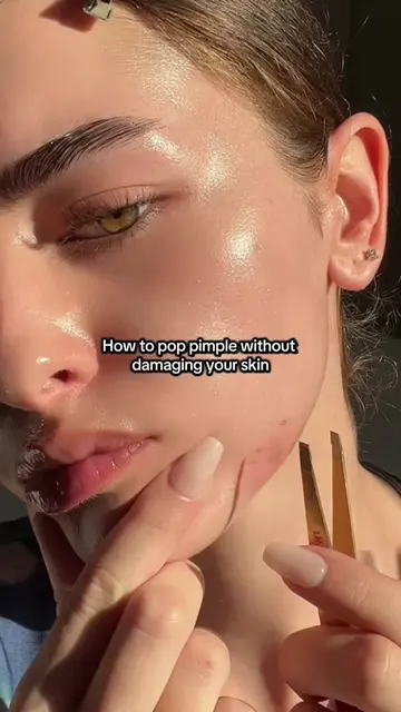 Reminder to stop popping your pimples 😭  #acneskin #skincare #acnetips 