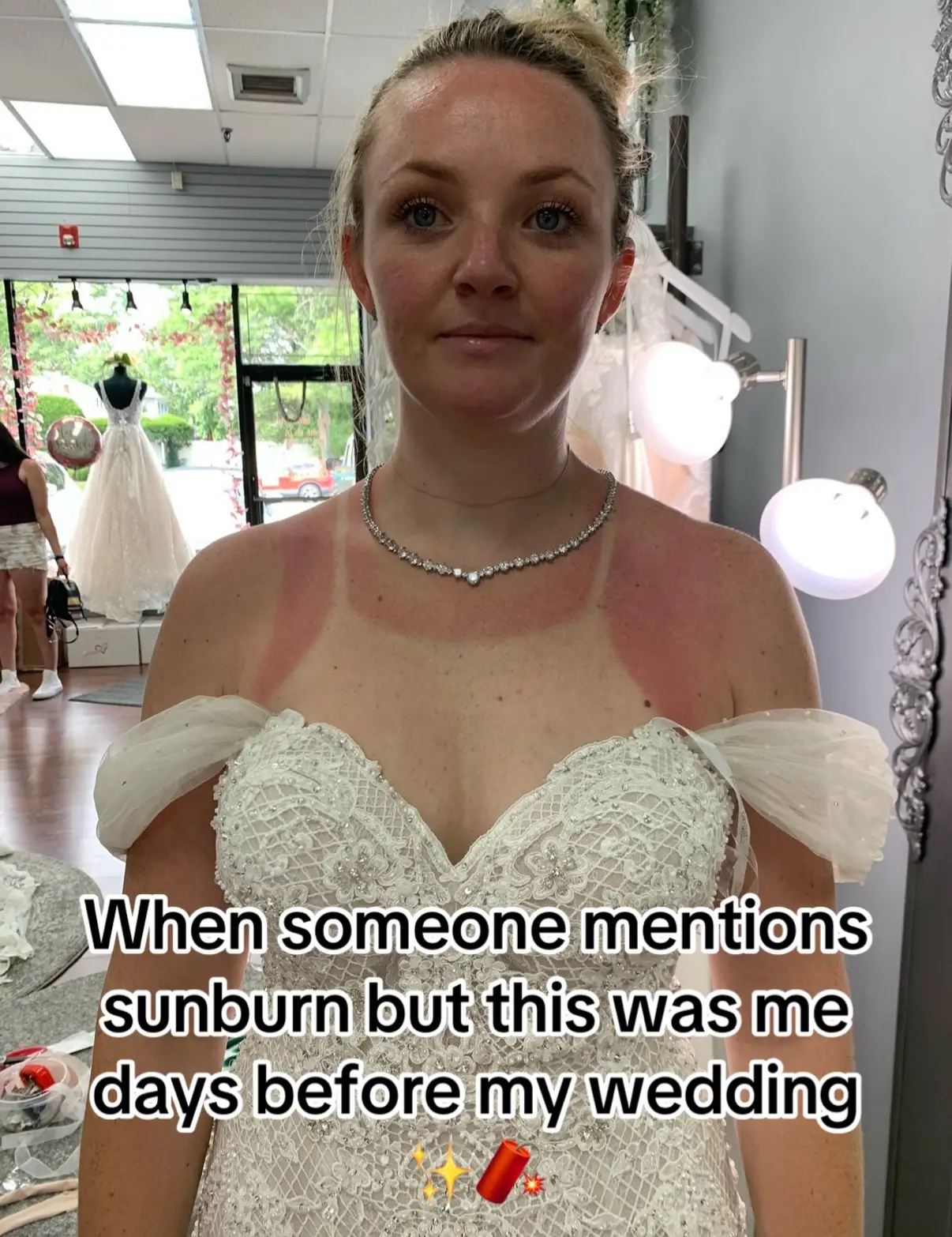 Body makeup & aloe STAT #bride #sunburn 